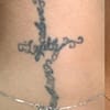 Three Sessions Of Laser Tattoo Removal: Small, Medium, Or Large Area Dubai - Image 3