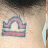 Three Sessions Of Laser Tattoo Removal: Small, Medium, Or Large Area Dubai - Image 5