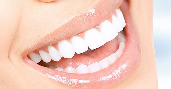Scaling And Polishing With X-Ray At Omar Yahia Dental Surgery Clinic Dubai